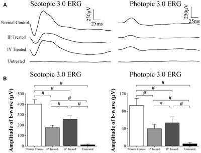 The Comparative Efficiency of Intraperitoneal and Intravitreous Injection of Hydrogen Rich Saline against N-Methyl-N-Nitrosourea Induced Retinal Degeneration: A Topographic Study